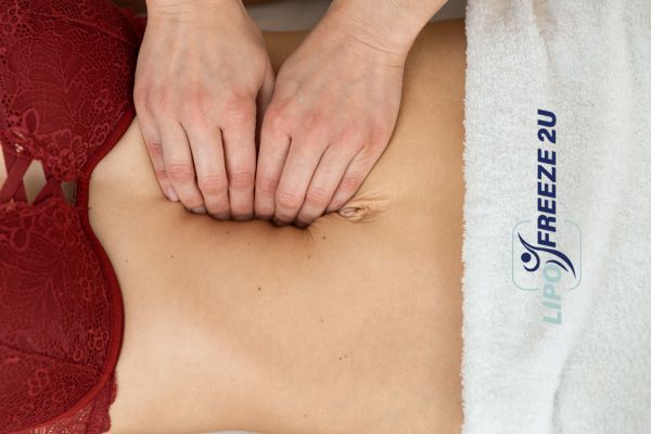 diastasis recti treatment Chipping Norton