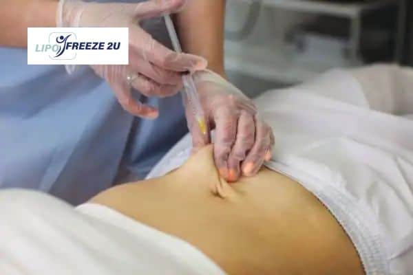 How Does Aqualyx Fat Dissolving Injection Work to Break Down Fat Chipping Norton?