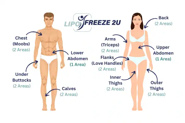 Areas you can have fat freezing treatment Chipping Norton