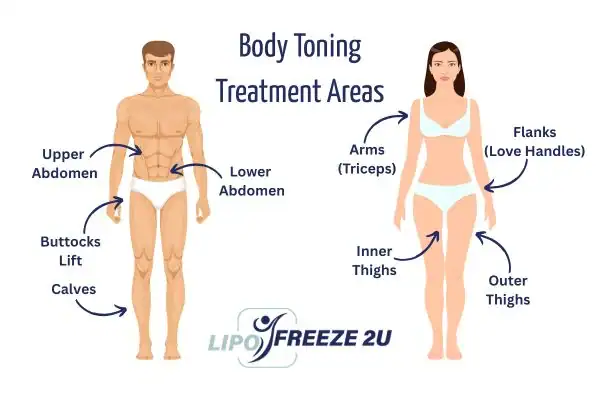 Graphic showing where you can have Body toning Treatment Chipping Norton on your body