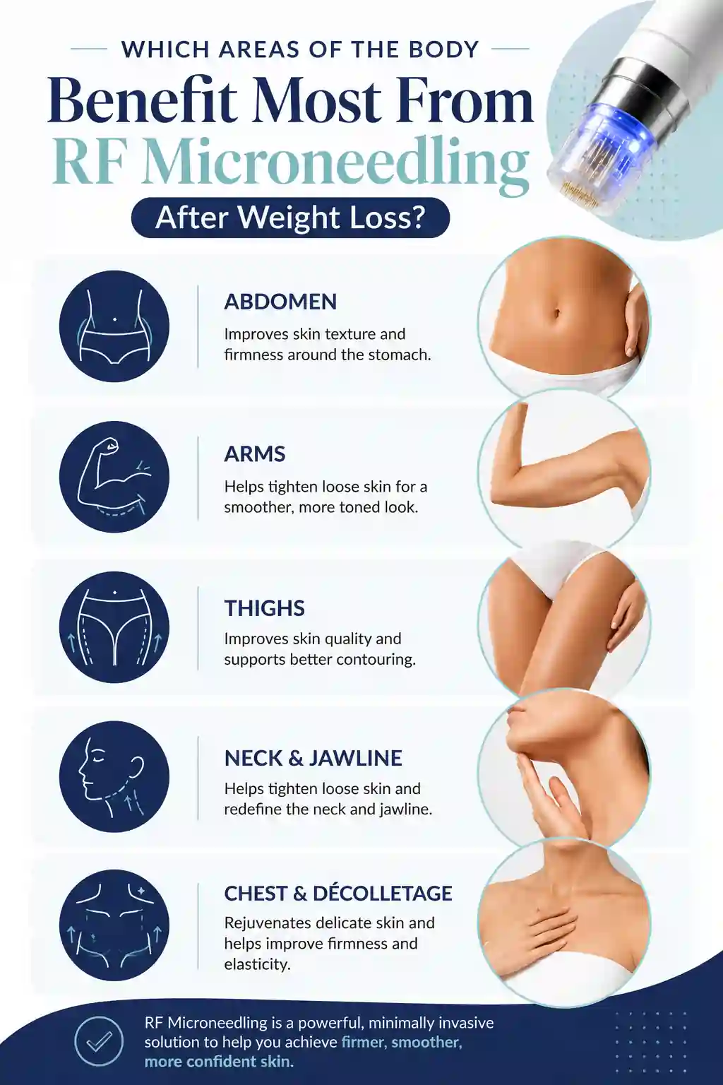 Which Areas of the Body Benefit Most From RF Microneedling After Weight Loss Chipping Norton